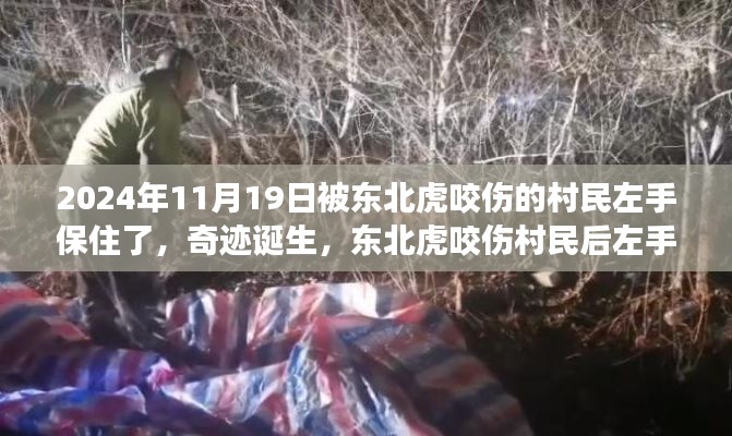 東北虎咬傷村民后奇跡誕生，左手成功保住