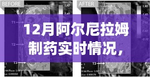 阿爾尼拉姆制藥12月實(shí)時(shí)動(dòng)態(tài)，生產(chǎn)進(jìn)展、市場(chǎng)洞察一覽無(wú)余